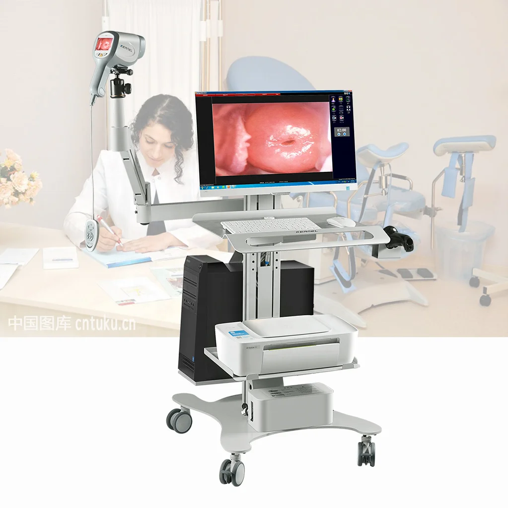 Hot Sale OEM Medical Optical Instrument high-resolution video Colposcopy Gynecology Health Colposcopy Digital