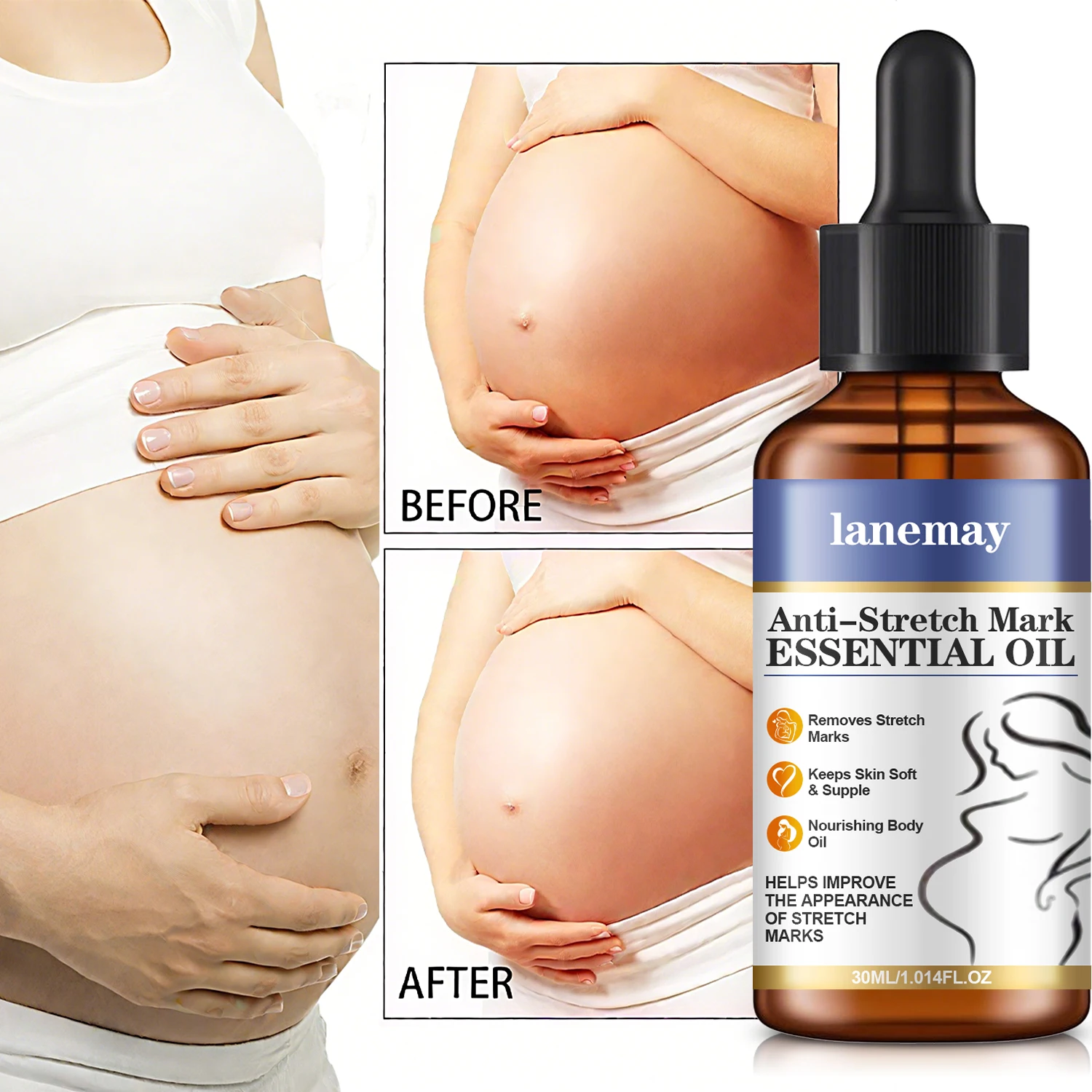 

Collagen Stretch Marks Remover Essential Oil Pregnancy Maternity Body New Old Stretch Mark Removal Serum Increase Elasticity