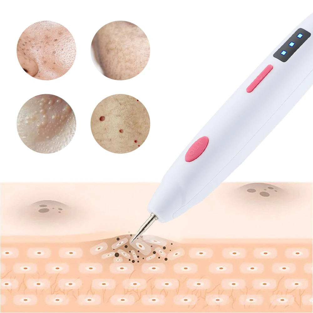 Skin Tag Remover Laser Plasma Pen Black Spots Mole Papilloma Warts Pimples Tattoo Remover Freckle Pen Face Cleaner Skin Care