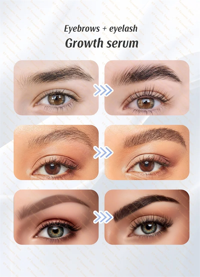 Snelle Wimpergroei Serum Wenkbrauw Haargroei Anti Haaruitval Product Voorkomen Kaalheid Voller Dikkere Verlenging Wenkbrauw Make-up