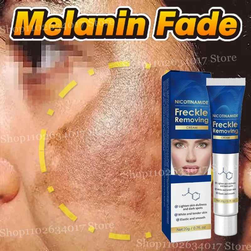 Reducir el melasma, aclarar la piel opaca, crema blanqueadora