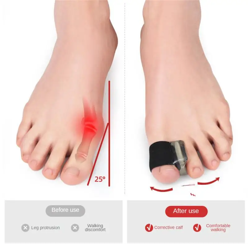 Corrector de manga para dedos de los pies con agujeros, separador de dedos, Corrector de juanetes de tela con forro de Gel para aliviar el dolor de juanetes y dedos superpuestos