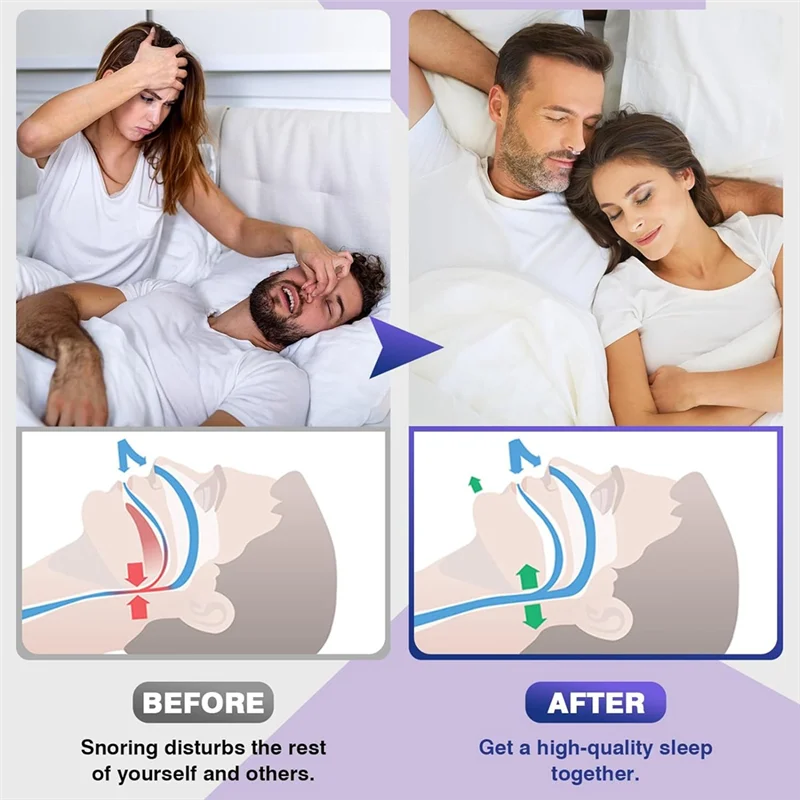 

Snore Stopper Snore Stopper With Adjustable Magnet, Snoring Solution For Comfortable And Quieter Sleep, 8PCS