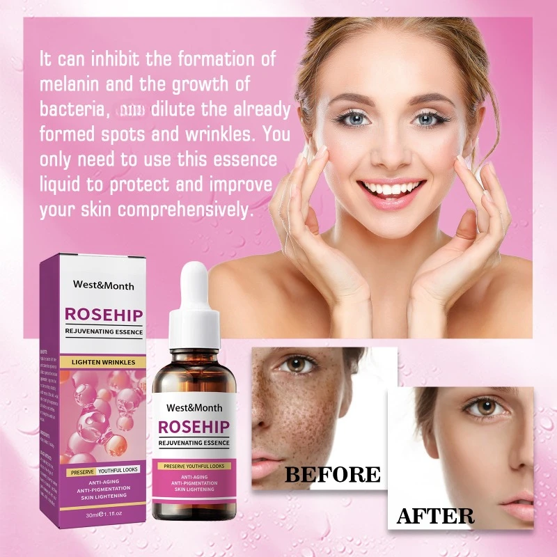 Rosehip Moisturizing Essence Wrinkle Removing Cream Anti Aging Firming Lifting Fade Fine Lines spots Brightening Skin Care Serum