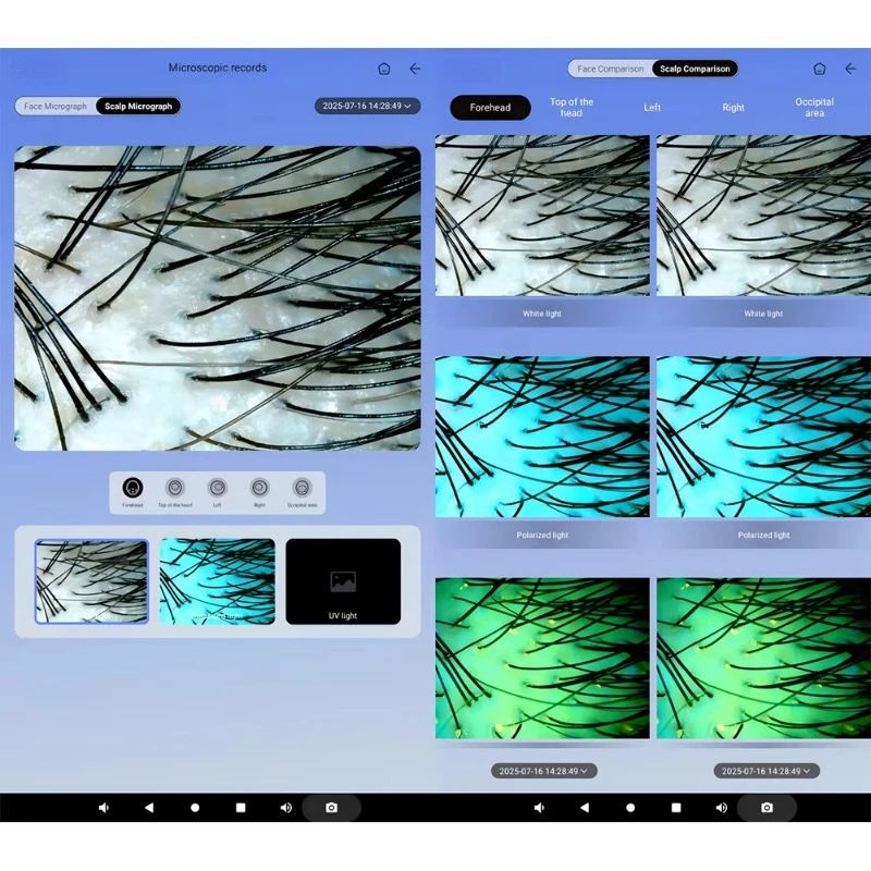 เครื่องวิเคราะห์หนังศีรษะและผิวหน้า 2 in 1 เทคโนโลยีใหม่ล่าสุด พร้อมระบบสแกน 3 มิติ AI