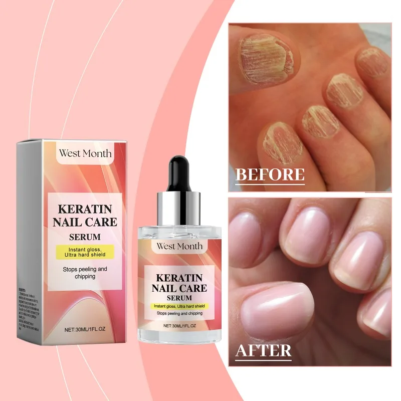 Nail Care Essence Repair Cuticle Hand and Foot Nail Strengthening Finger Edge Anti-Infection Toe Fungus Oil Moisturizing Care