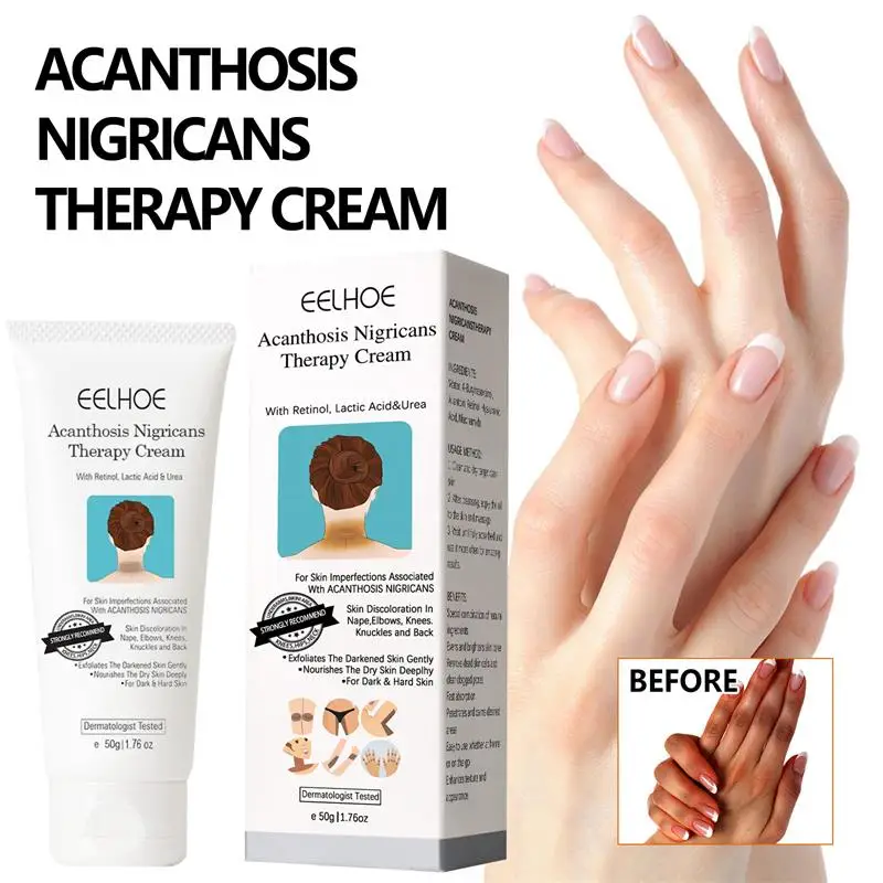 Brighten Cream Bleaching Armpits Elbows Knees Moisturizing Body Lotion Cream Brightening Lightening Melanin Skin Cream