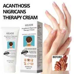 Brighten Cream sbiancante ascelle gomiti ginocchia idratante lozione per il corpo crema schiarente schiarente crema per la pelle alla melanina