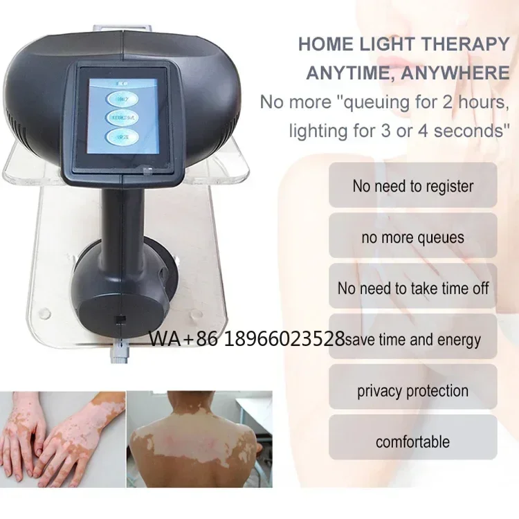 

Hot Sales Man /Woman Vitiligo Treatment Excimer 308nm Psoriasis Machine For Clinic