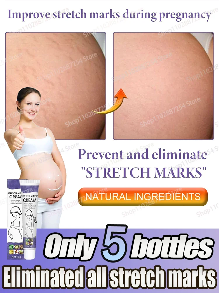 

Fast Scar Repair Cream Skin Scar Repair Remove Pregnancy Surgical Scars Treatment Body Skin Care 0924