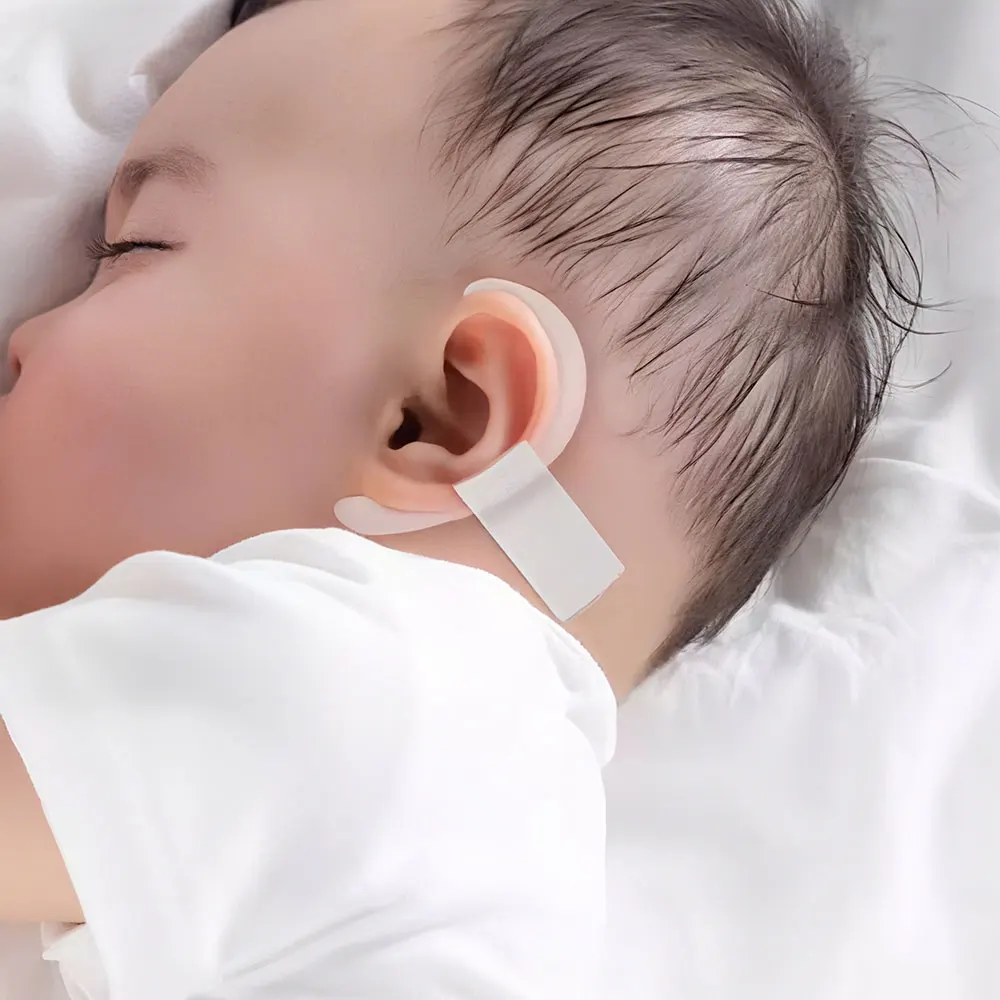 Protruding Ear Support Infant Corrector Tools Silicone Auricle Correction Patch For BabyEar Corrector Baby Auricle Valgus Kit view 2