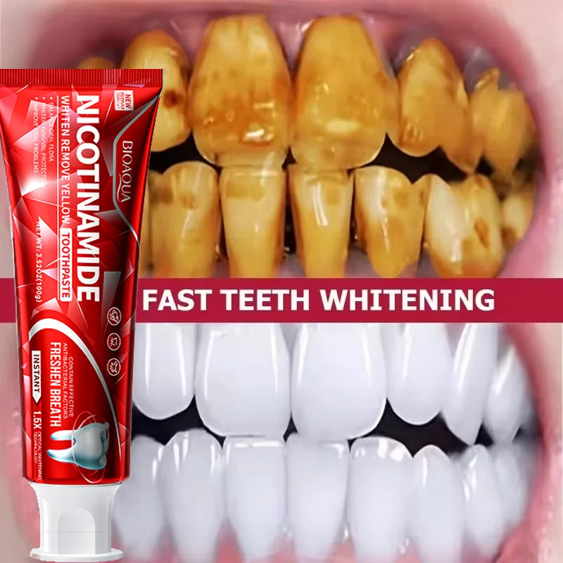 

100g Teeth Whitening Toothpaste Remove Smoke Tea Plaque Stains Repair Gum Oral Hygiene Cleaning Fresh Breath Dental Tooth Care