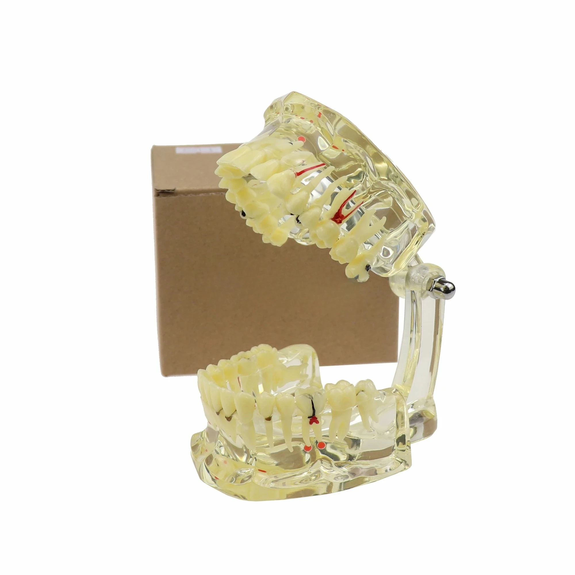 

Dentals Teeth Model Transparents Adult Pathologicals Model With Missing Tooth For Demonstrating