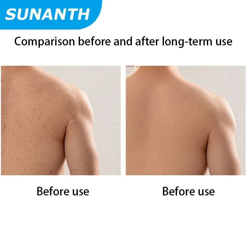 ผ้าเช็ดตัวโฟมพร้อมแปรงขัดหลังแถบยาวที่แข็งแกร่งสําหรับผู้ชายและผู้หญิงเครื่องมือในครัวเรือนเพื่อขจัดผิวที่ตายแล้ว