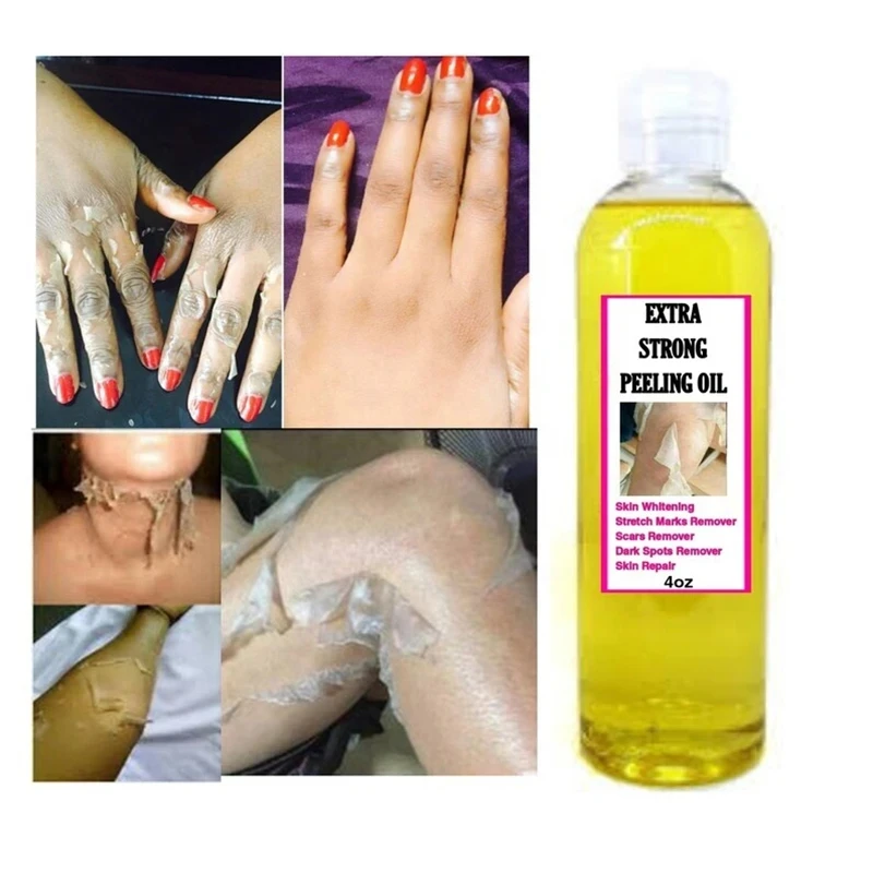 Yellow peeling oil strong yellow peeling oil Lighten elbows knees hands melanin even skin tone and whiten skin