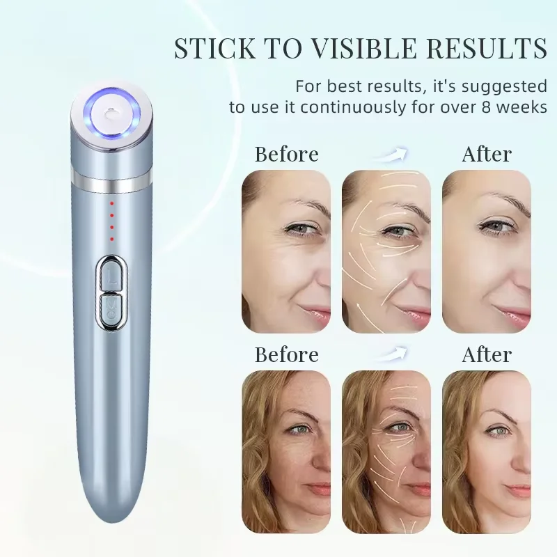Masseur oculaire EMS, Instrument de beauté Anti-âge, soins oculaires, outil de Massage, élimination des rides, Lifting du visage, appareil de beauté, usage domestique