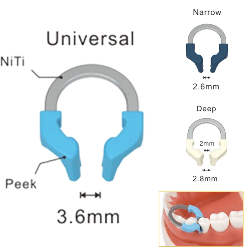 Bandes de Matrices Dentaires Niti en Métal Anneau de Serrage, Système de Matrices Sectionnelles, Nickel, Titane, Anneaux de Serrage, Accessoire