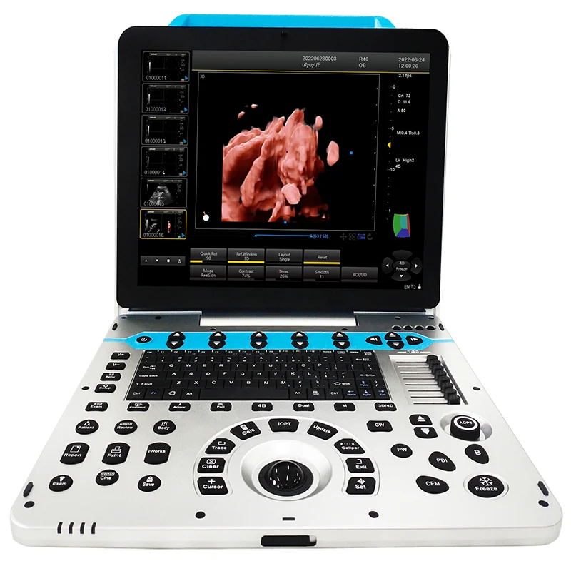 3D-Scanner für tragbare medizinische Geräte für OB/GYN