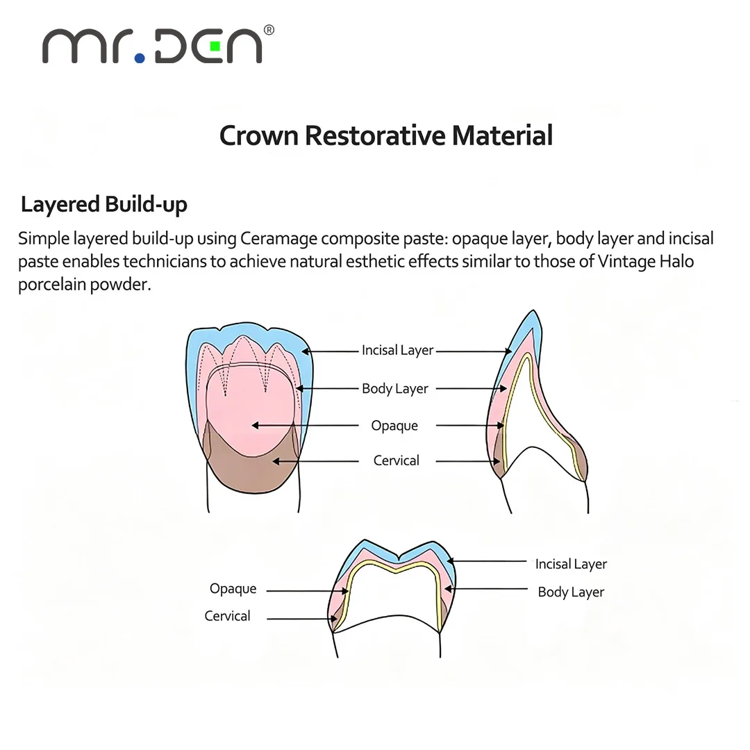 Dental Ceramage Light‑cured Crown Composite Hard Resin, Gingiva GUM Ceramage Flowable Resin for Dental Restoration