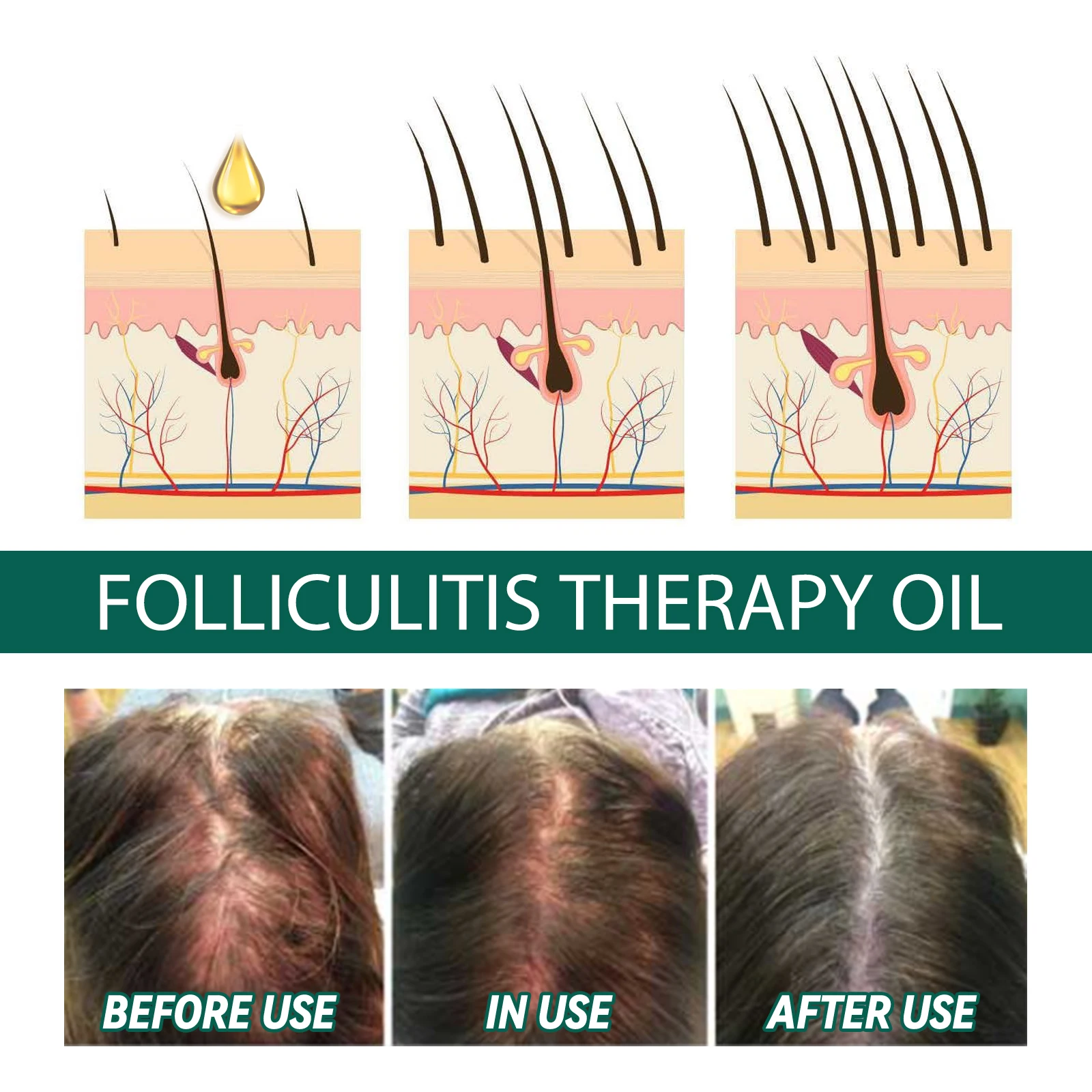 Scalp Treatment Serum Follicle - Roots Nutrition & Fitness Inglewood Photos 评论和价格