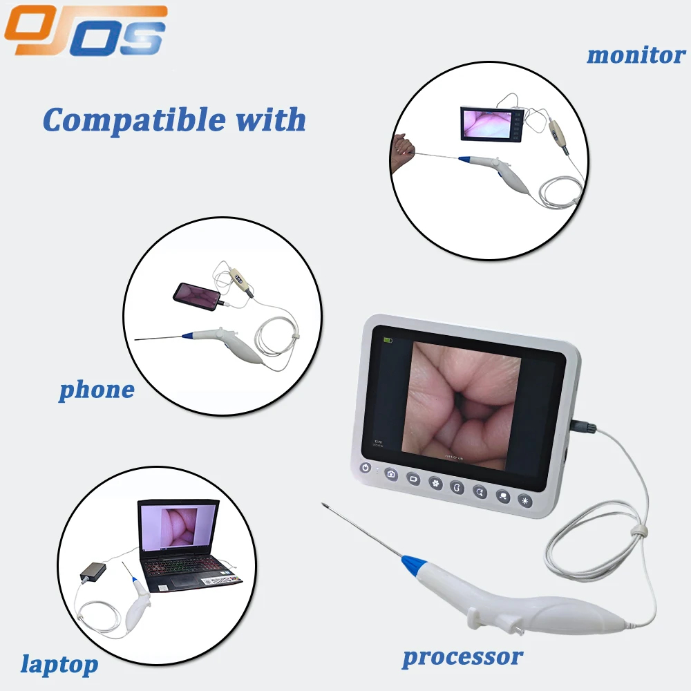 5.0mm Medical Inspection Endoscope Single Use Hysteroscope Disposable Uteroscope for Vet Market