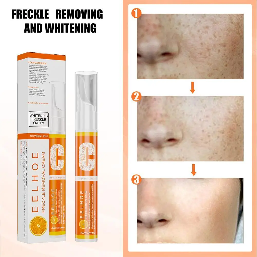 15ML VC Fade Pen Vitamin C Instant Spot Removal Gel Pen Removal Spot Spots Freckles Effective Pigment Whitening U0O9