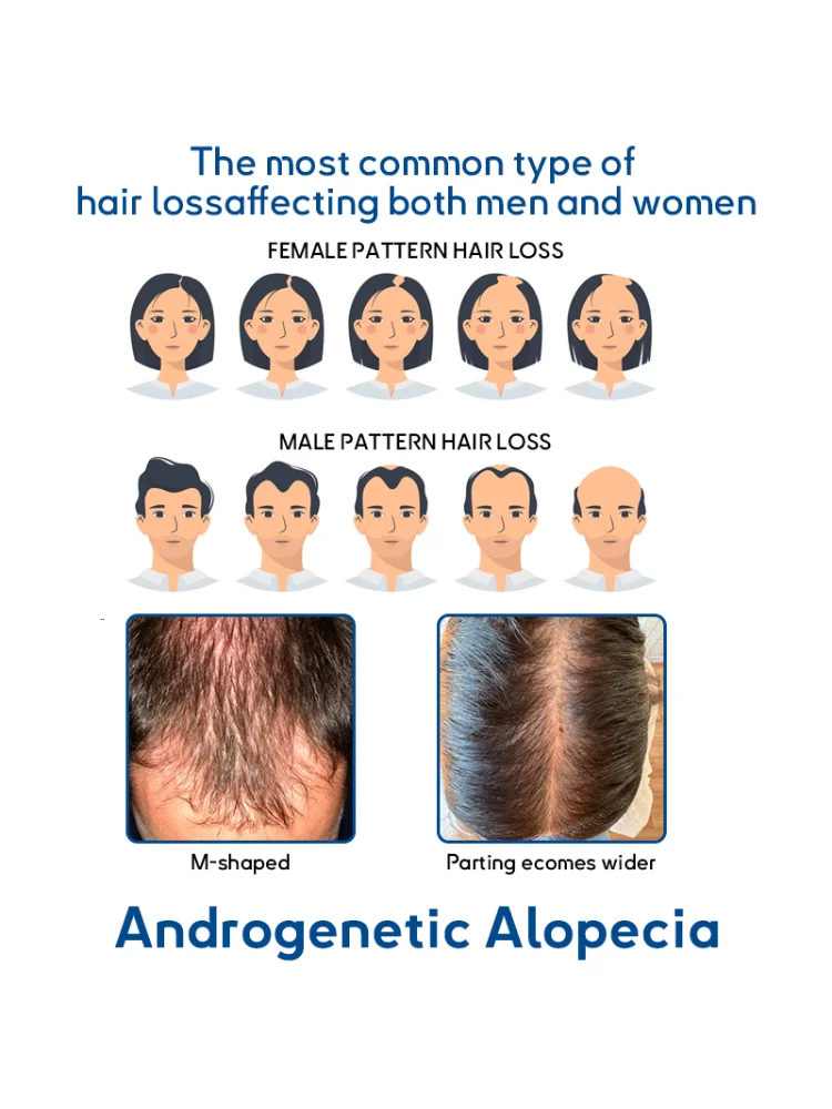 Estimulador poderoso de folículos: embalado com nutrientes de crescimento, amplifica a densidade, reduz a quebra, aumenta a bloqueios exuberantes