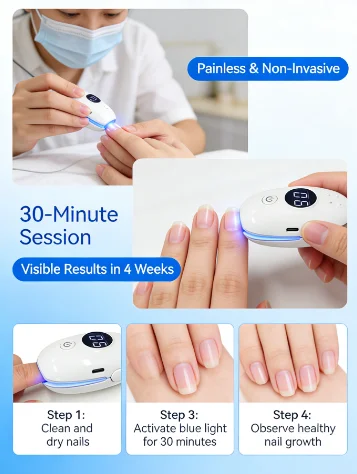 

7-минутный лазерный аппарат для лечения грибка ногтей – неинвазивная светотерапия для восстановления ногтей, альтернатива пероральным препаратам