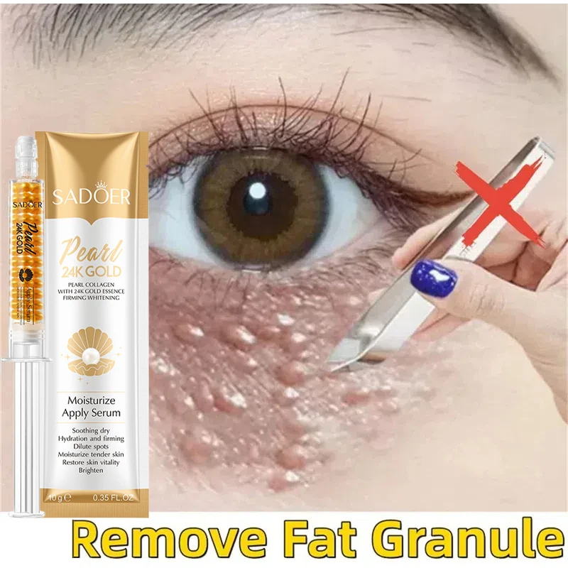 Hyaluronic Acid Fat Granules Removal Eye Essence Moisturizing&rejuvenating Lotion Anti Dark Circle Eye Bags Fade Anti-puffiness