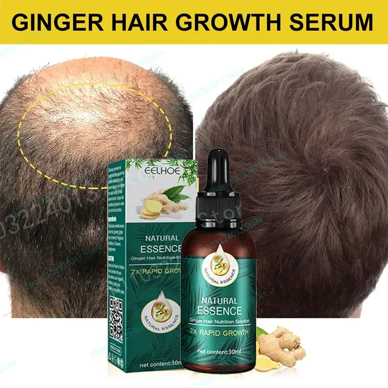 

Sdotter New Oil Hair Growth Products for Man Women Ginger Anti Hair Loss Fast Regrowth