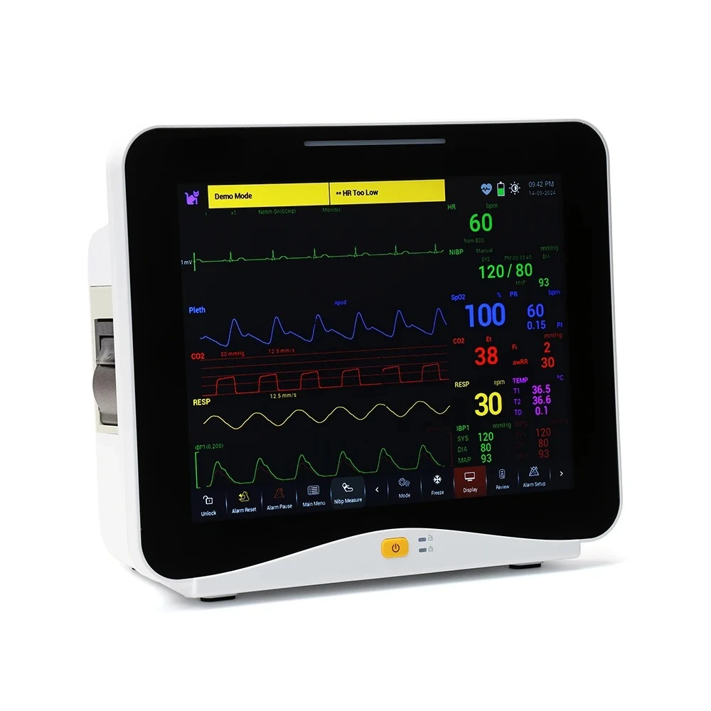 

Lexison PPM-H12V 12.1inch Touch Screen Multi-parameter Patient Monitor- for Use for Pets
