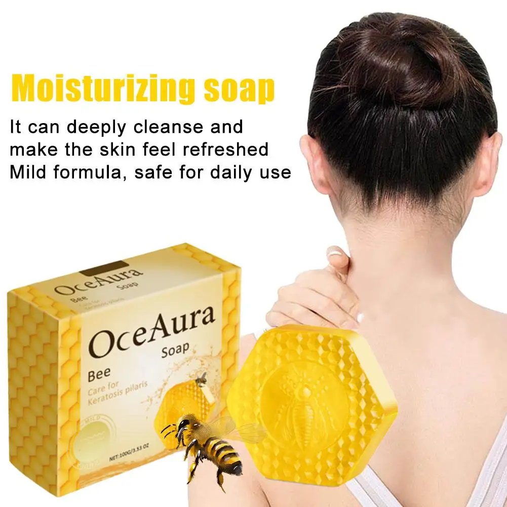 100g Bee Handmade Soap Reduce Acne Skin Itching Moisturizing Acne Soap Cleansing Skin Care Body J9v3