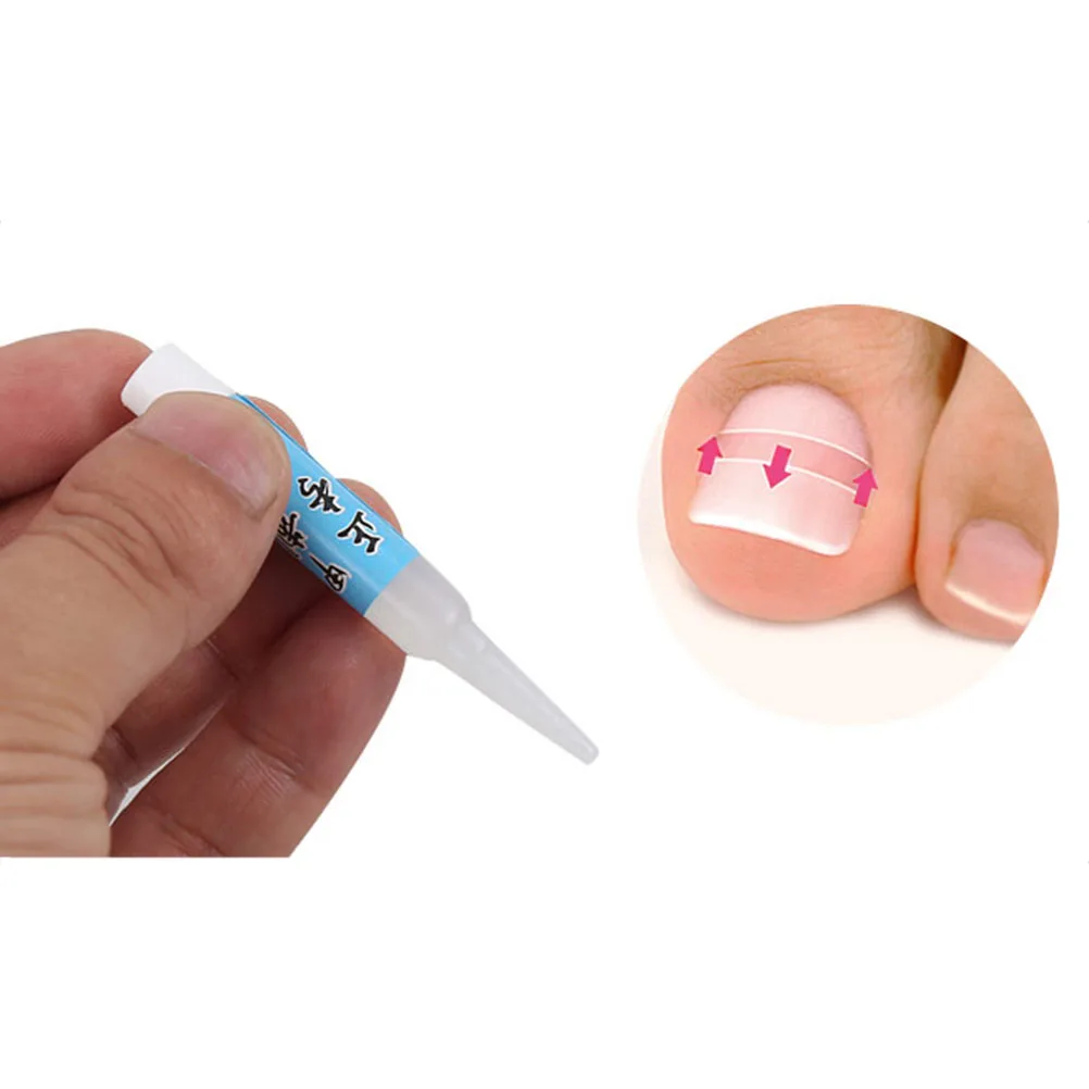 

Nail Glue Adhesive For Toenail Correction Patches Wire Ingrown Toenail Treatment Foot Care Tool Pedicure Supplies Nail Care