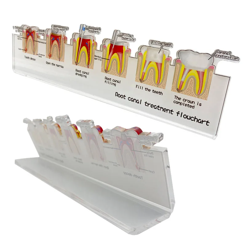 Dental Root Canal Treatment Flowchart Stand Endodontic Process Guide Dental Lab Study Teaching Demonstration Model Dentist Gift