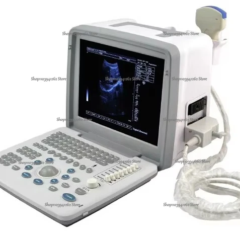 S300 Portable Hospital cheapest Digital medical ultrasound machine handheld device with Scanner price B-mode ultrasonography