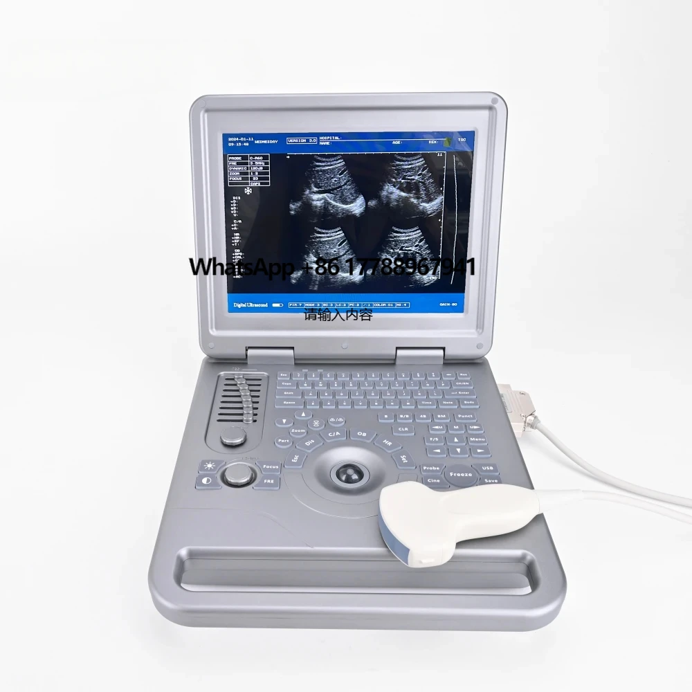 

New Medical 12 Inch Portable White and Black Ultrasound Scanner Device Ultrasonic Machine System with Convex Probe for Diagnosis