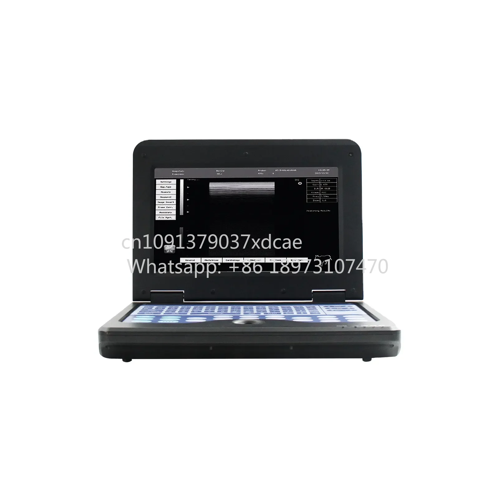 Color Tablet Ultrasound Portable Usg Machine Full Digital Portable B/W Ultrasound Scanner For Human