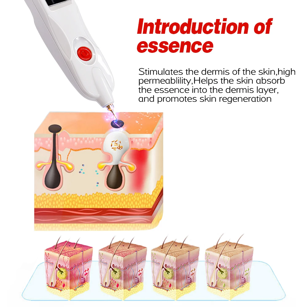 Professioneller Plasma-Pen zur Entfernung von Sommersprossen, Falten, Muttermalen, Tattoos, Mitessern, dunklen Flecken und Pigmenten, Hautpflegegerät, ionischer Schönheitsstift – Detail 13