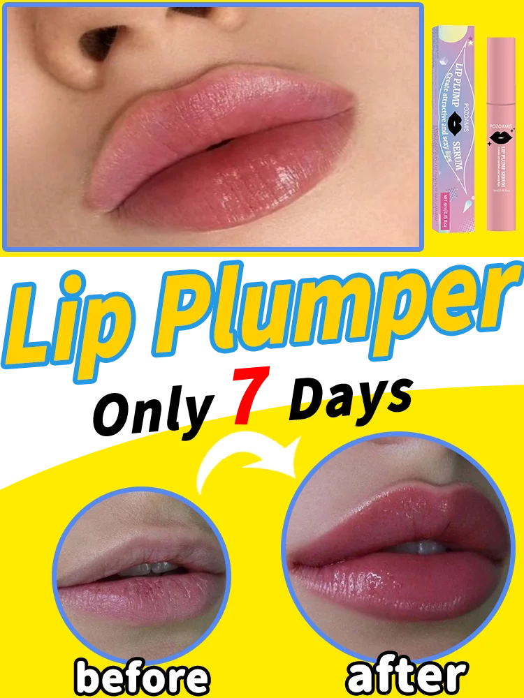 

Big lips