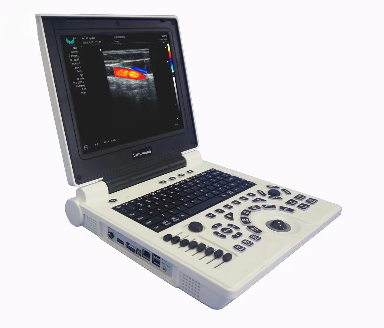 Digital Mobile Notebook Medical Ultrasound Diagnostic System Portable 3D 4D CW Color Doppler Ultrasound Laptop Scanner Machine