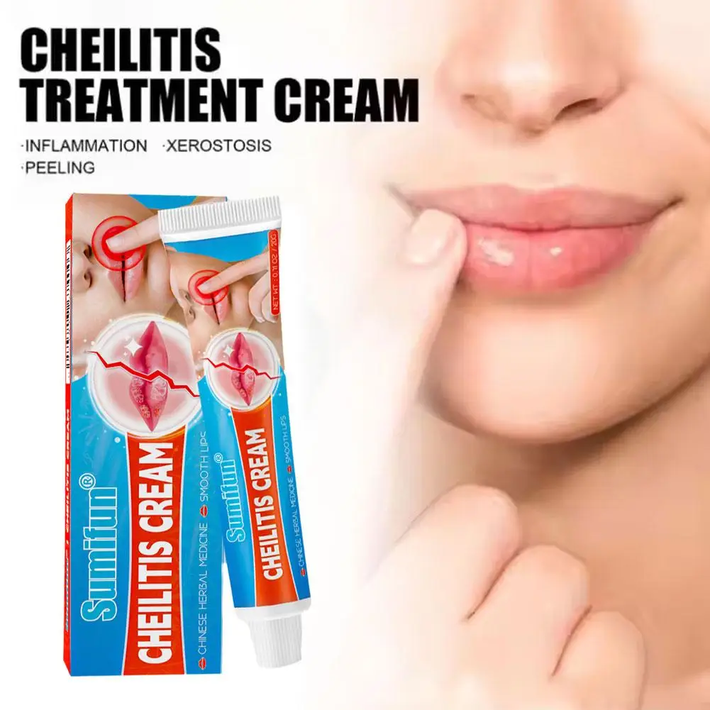 20g Cheilitis Balm Lip Care Skin External Cream  for Dry Chapped Cracked Peeling and Bleeding Lips