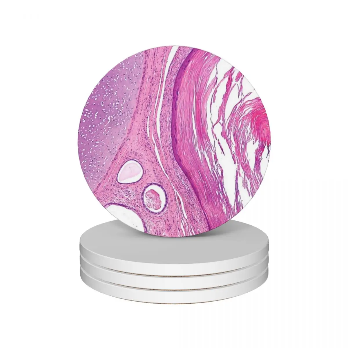 

Teratoma Histology Ceramic Coasters (Set of 4) cute cup drinks Coasters