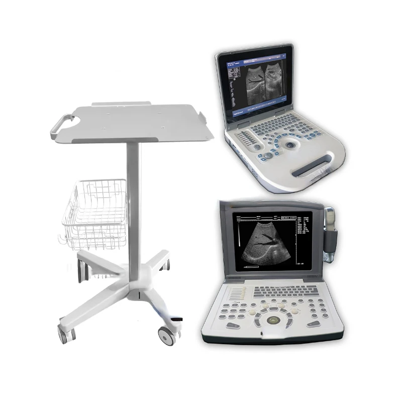 RS01 Best Selling ultrasonic diagnostic machine Medical Diagnostic Scanner Trolley  For Medical Use Ultrasound Trolley