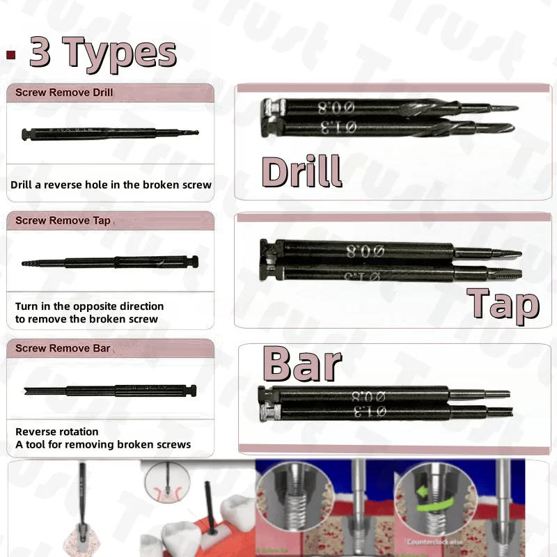 

Implant Fixture Fractured Dental Broken Screws Remover Tap Drill Bar Extractor for Efficient Dental Repairs Tools