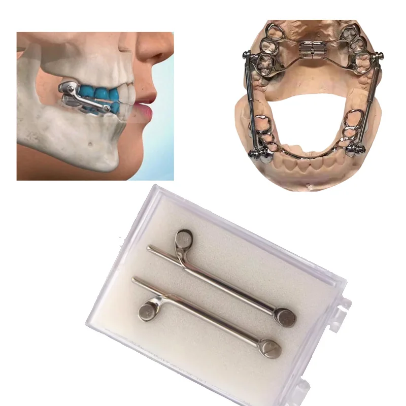 1 conjunto de aparelho dental herbst conjunto denturum parafuso soquete telescópico ortodôntico classe ii correção