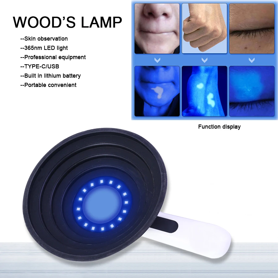 Woods Lamp Skin Analyzer Portable Facial Analyzer UV Lamp Wood Dermatology For Analyzing vitiligo Detection lamp