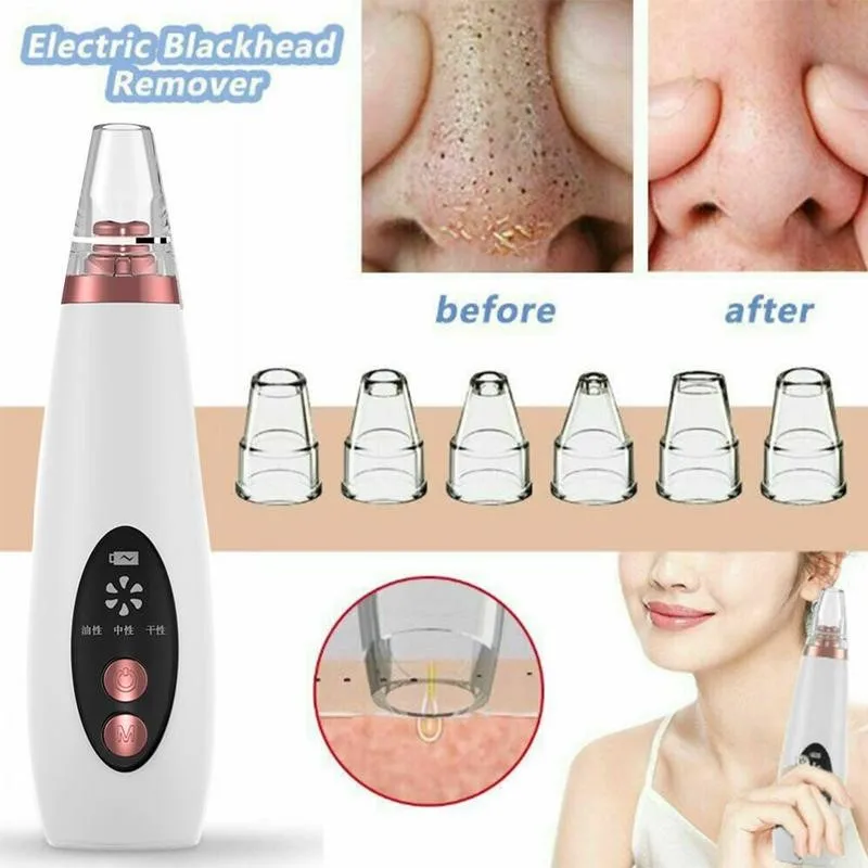 USB Mee-eter Black Dot Remover Gezicht Porie Vacuüm Huidverzorging Acne Pore Cleaner Puistje Verwijderen Vacuümzuiggereedschap