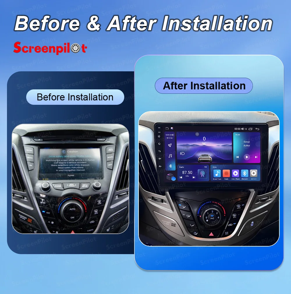 Android 16 Car Radio Stereo Head Unit For Hyundai Veloster FS 2011 - 2017 Multimedia Video Player GPS Navigation Touch Screen