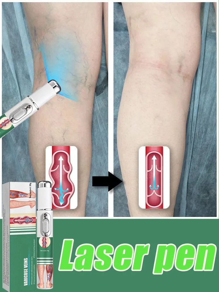 

Laser pen Household care tool for men and women