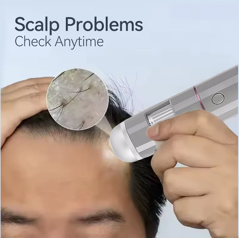 Analisador de diagnóstico de pele sem fio WiFi USB recarregável analisador de couro cabeludo detector máquina analisadora de cabelo